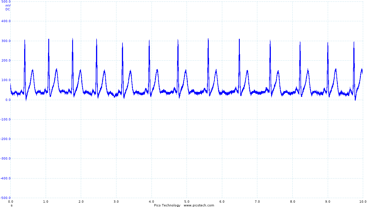 ECG trace with the output stage filter